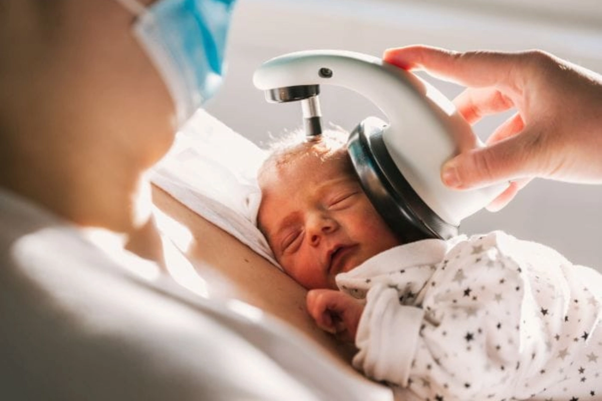 Auditory Steady-State Response (ASSR) Test